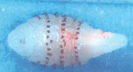 human botfly larva